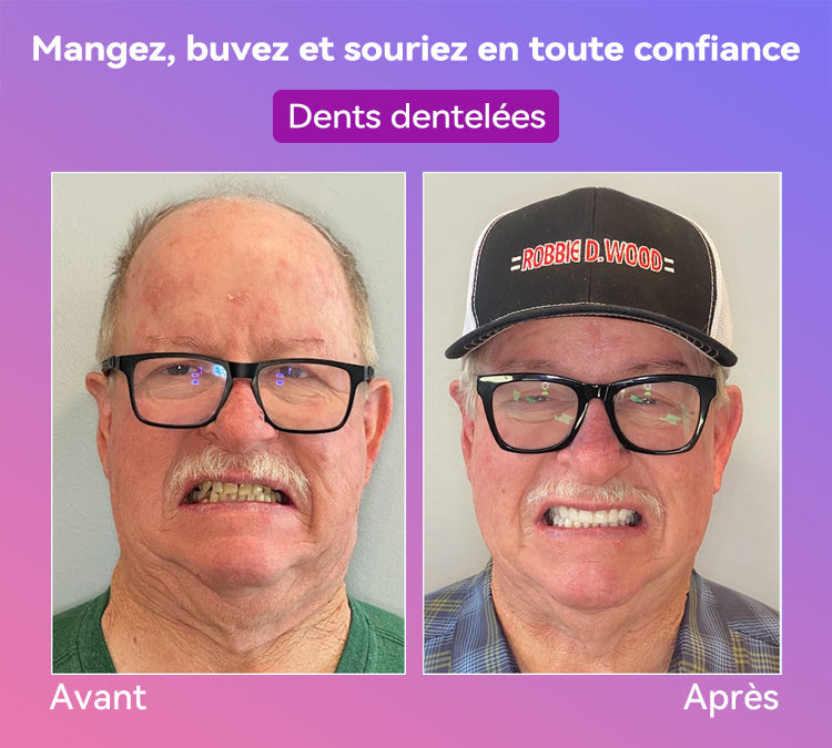 𝐉𝐚𝐬𝐬𝐞𝐞𝐦® Dernières Prothèses Dentaires Premium Confort🏆 (Prothèses haut de gamme, Confortables à Porter - Remise de 70% pour une durée limitée)🔥