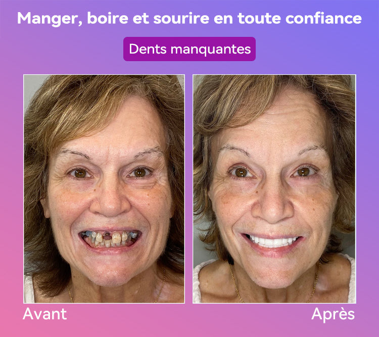 𝐉𝐚𝐬𝐬𝐞𝐞𝐦® Dernières Prothèses Dentaires Premium Confort🎁(Prothèses haut de gamme, Confortables à Porter - Remise de 70% pour une durée limitée)