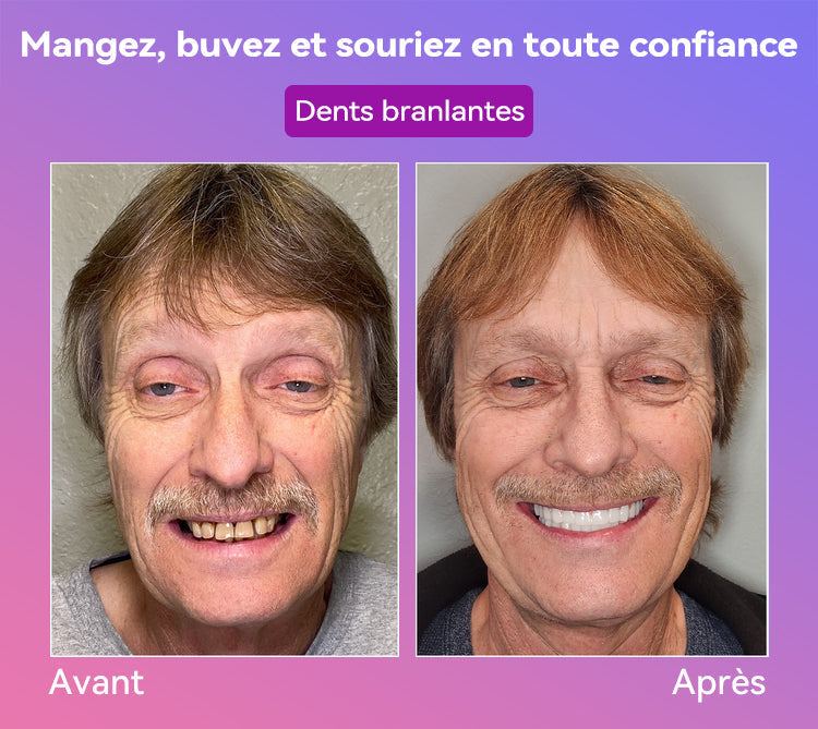 𝐉𝐚𝐬𝐬𝐞𝐞𝐦® Dernières Prothèses Dentaires Premium Confort🎁(Prothèses haut de gamme, Confortables à Porter - Remise de 70% pour une durée limitée)