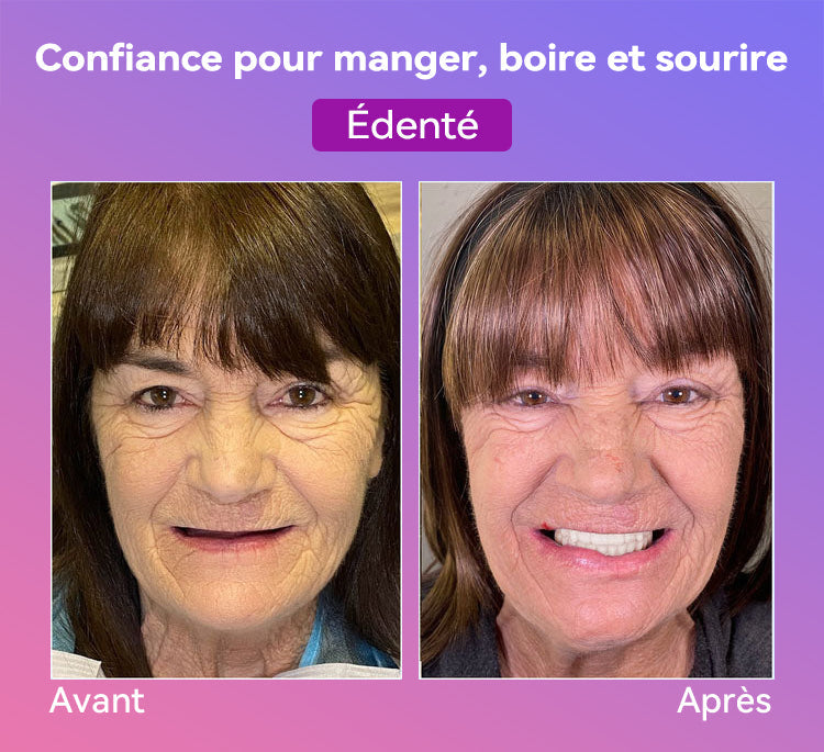 𝐉𝐚𝐬𝐬𝐞𝐞𝐦® Dernières Prothèses Dentaires Premium Confort🎁(Prothèses haut de gamme, Confortables à Porter - Remise de 70% pour une durée limitée)