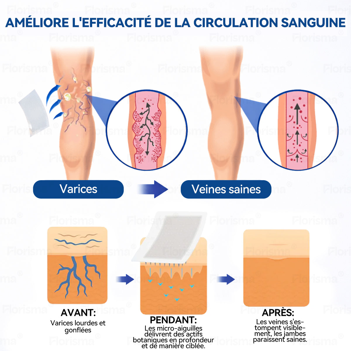 🛡️ 𝑭𝑳𝑶𝑹𝑰𝑺𝑴𝑨® 🎉 Patch à Micro‑aiguilles de Grade Clinique au Diosmine & Hespéridine — Un mélange avancé d’extraits végétaux conçu pour cibler les varicosités et les varices tout en aidant à soulager les jambes lourdes et fatiguées. 👩‍⚕️