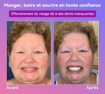 𝐉𝐚𝐬𝐬𝐞𝐞𝐦® Dernières Prothèses Dentaires Premium Confort🎁(Prothèses haut de gamme, Confortables à Porter - Remise de 70% pour une durée limitée)