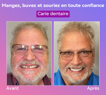 𝐉𝐚𝐬𝐬𝐞𝐞𝐦® Dernières Prothèses Dentaires Premium Confort🏆 (Prothèses haut de gamme, Confortables à Porter - Remise de 70% pour une durée limitée)🔥