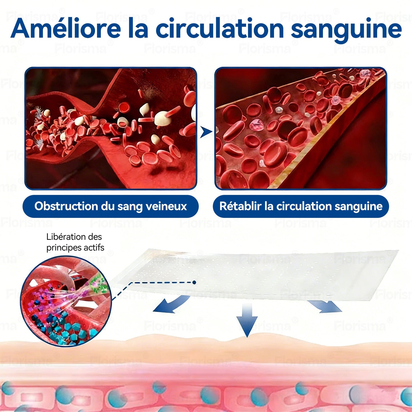 🛡️ 𝑭𝑳𝑶𝑹𝑰𝑺𝑴𝑨® 🎉 Patch à Micro‑aiguilles de Grade Clinique au Diosmine & Hespéridine — Un mélange avancé d’extraits végétaux conçu pour cibler les varicosités et les varices tout en aidant à soulager les jambes lourdes et fatiguées. 👩‍⚕️