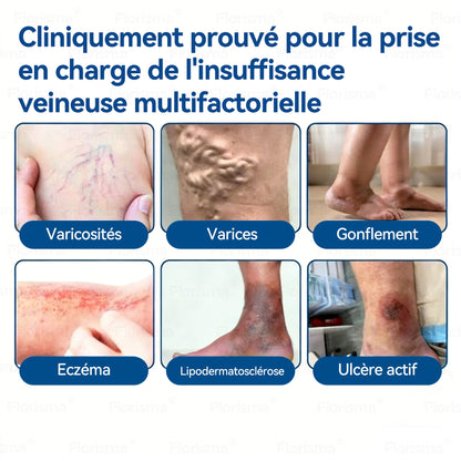 🛡️ 𝑭𝑳𝑶𝑹𝑰𝑺𝑴𝑨® 🎉 Patch à Micro‑aiguilles de Grade Clinique au Diosmine & Hespéridine — Un mélange avancé d’extraits végétaux conçu pour cibler les varicosités et les varices tout en aidant à soulager les jambes lourdes et fatiguées. 👩‍⚕️