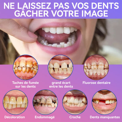 𝐉𝐚𝐬𝐬𝐞𝐞𝐦® Dernières Prothèses Dentaires Premium Confort🏆 (Prothèses haut de gamme, Confortables à Porter - Remise de 70% pour une durée limitée)🔥