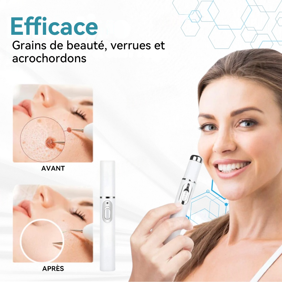 𝐉𝐚𝐬𝐬𝐞𝐞𝐦® Stylo Laser de Qualité Médicale 🏆 (utilise la technologie laser au CO₂ – efficace pour éliminer les grains de beauté, les verrues, les acrochordons, les taches pigmentaires et autres imperfections)🔥