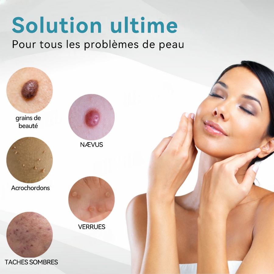 𝐉𝐚𝐬𝐬𝐞𝐞𝐦® Stylo Laser de Qualité Médicale 🏆 (utilise la technologie laser au CO₂ – efficace pour éliminer les grains de beauté, les verrues, les acrochordons, les taches pigmentaires et autres imperfections)🔥