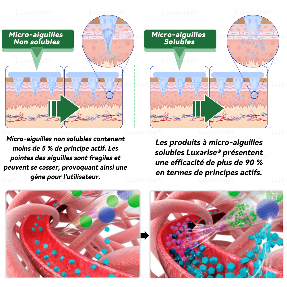 🎁🎁 𝑳𝒖𝒙𝒂𝒓𝒊𝒔𝒆® 𝑴𝒐𝒓𝒊𝒏𝒈𝒂 & 𝑩𝒆𝒓𝒃é𝒓𝒊𝒏𝒆 10-𝒆𝒏-1 𝑷𝒂𝒕𝒄𝒉 𝑨𝒗𝒂𝒏𝒄é 𝒅𝒆 𝑴𝒊𝒄𝒓𝒐𝒏𝒆𝒆𝒅𝒍𝒆𝒔 𝑵𝒂𝒏𝒐 (𝐔𝐧𝐞 𝐚𝐩𝐩𝐥𝐢𝐜𝐚𝐭𝐢𝐨𝐧 𝐩𝐚𝐫 𝐣𝐨𝐮𝐫, 𝐜𝐡𝐚𝐧𝐠𝐞𝐦𝐞𝐧𝐭𝐬 𝐯𝐢𝐬𝐢𝐛𝐥𝐞𝐬 𝐞𝐧 𝟕 𝐣𝐨𝐮𝐫𝐬)✅ 𝐎𝐛é𝐬𝐢𝐭é · 𝐃𝐢𝐚𝐛è𝐭𝐞 · 𝐀𝐩𝐧é𝐞 𝐝𝐮 𝐬𝐨𝐦𝐦𝐞𝐢𝐥 · 𝐏𝐫𝐨𝐛𝐥è𝐦𝐞𝐬 𝐚𝐫𝐭𝐢𝐜𝐮𝐥𝐚𝐢𝐫𝐞𝐬