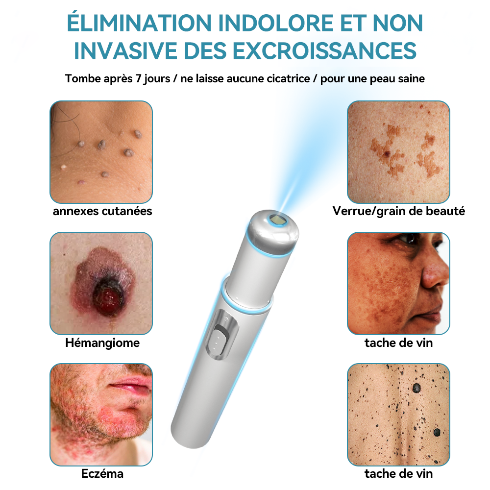 𝐉𝐚𝐬𝐬𝐞𝐞𝐦® Stylo Laser de Qualité Médicale 🏆 (utilise la technologie laser au CO₂ – efficace pour éliminer les grains de beauté, les verrues, les acrochordons, les taches pigmentaires et autres imperfections)🔥