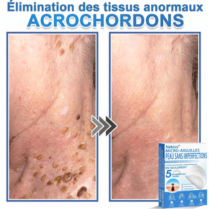 💧💧 𝑩𝒐𝒖𝒕𝒊𝒒𝒖𝒆 𝑶𝒇𝒇𝒊𝒄𝒊𝒆𝒍𝒍𝒆|𝐍𝐞𝐊𝐢𝐬𝐬® 🌿𝐏𝐚𝐭𝐜𝐡 𝐇𝐲𝐝𝐫𝐨𝐜𝐨𝐥𝐥𝐨ï𝐝𝐞 𝐁𝐨𝐭𝐚𝐧𝐢𝐪𝐮𝐞 à 𝐌𝐢𝐜𝐫𝐨-𝐀𝐢𝐠𝐮𝐢𝐥𝐥𝐞𝐬( 𝐂𝐢𝐛𝐥𝐞 𝐥𝐞𝐬 𝐚𝐜𝐫𝐨𝐜𝐡𝐨𝐫𝐝𝐨𝐧𝐬, 𝐩𝐞𝐭𝐢𝐭𝐞𝐬 𝐞𝐱𝐜𝐫𝐨𝐢𝐬𝐬𝐚𝐧𝐜𝐞𝐬, 𝐯𝐞𝐫𝐫𝐮𝐞𝐬, 𝐠𝐫𝐚𝐢𝐧𝐬 𝐝𝐞 𝐛𝐞𝐚𝐮𝐭é, 𝐭𝐚𝐜𝐡𝐞𝐬 𝐝𝐞 𝐯𝐢𝐞𝐢𝐥𝐥𝐞𝐬𝐬𝐞 𝐞𝐭 𝐚𝐮𝐭𝐫𝐞𝐬 𝐢𝐦𝐩𝐞𝐫𝐟𝐞𝐜𝐭𝐢𝐨𝐧𝐬 𝐜𝐮𝐭𝐚𝐧é𝐞𝐬 𝐨𝐮 𝐩𝐢𝐠𝐦𝐞𝐧𝐭𝐚𝐢𝐫𝐞𝐬 )