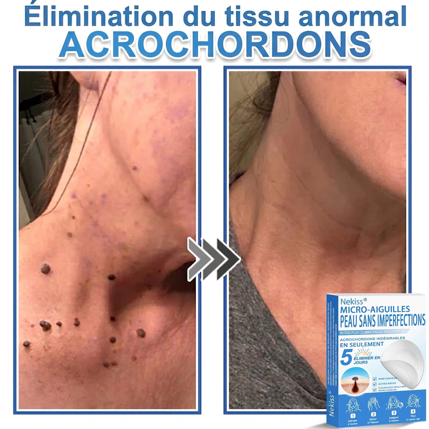 💧💧 𝑩𝒐𝒖𝒕𝒊𝒒𝒖𝒆 𝑶𝒇𝒇𝒊𝒄𝒊𝒆𝒍𝒍𝒆|𝐍𝐞𝐊𝐢𝐬𝐬® 🌿𝐏𝐚𝐭𝐜𝐡 𝐇𝐲𝐝𝐫𝐨𝐜𝐨𝐥𝐥𝐨ï𝐝𝐞 𝐁𝐨𝐭𝐚𝐧𝐢𝐪𝐮𝐞 à 𝐌𝐢𝐜𝐫𝐨-𝐀𝐢𝐠𝐮𝐢𝐥𝐥𝐞𝐬( 𝐂𝐢𝐛𝐥𝐞 𝐥𝐞𝐬 𝐚𝐜𝐫𝐨𝐜𝐡𝐨𝐫𝐝𝐨𝐧𝐬, 𝐩𝐞𝐭𝐢𝐭𝐞𝐬 𝐞𝐱𝐜𝐫𝐨𝐢𝐬𝐬𝐚𝐧𝐜𝐞𝐬, 𝐯𝐞𝐫𝐫𝐮𝐞𝐬, 𝐠𝐫𝐚𝐢𝐧𝐬 𝐝𝐞 𝐛𝐞𝐚𝐮𝐭é, 𝐭𝐚𝐜𝐡𝐞𝐬 𝐝𝐞 𝐯𝐢𝐞𝐢𝐥𝐥𝐞𝐬𝐬𝐞 𝐞𝐭 𝐚𝐮𝐭𝐫𝐞𝐬 𝐢𝐦𝐩𝐞𝐫𝐟𝐞𝐜𝐭𝐢𝐨𝐧𝐬 𝐜𝐮𝐭𝐚𝐧é𝐞𝐬 𝐨𝐮 𝐩𝐢𝐠𝐦𝐞𝐧𝐭𝐚𝐢𝐫𝐞𝐬 )