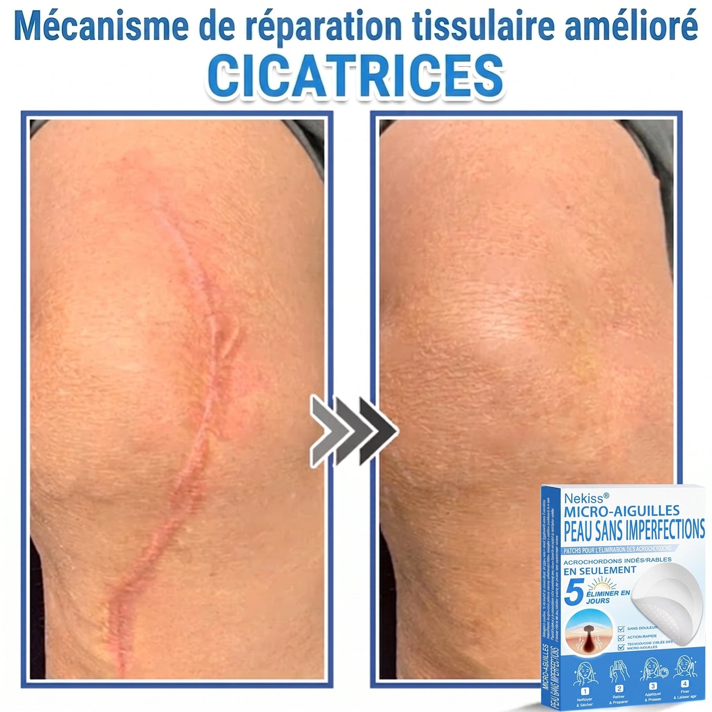💧💧 𝑩𝒐𝒖𝒕𝒊𝒒𝒖𝒆 𝑶𝒇𝒇𝒊𝒄𝒊𝒆𝒍𝒍𝒆|𝐍𝐞𝐊𝐢𝐬𝐬® 🌿𝐏𝐚𝐭𝐜𝐡 𝐇𝐲𝐝𝐫𝐨𝐜𝐨𝐥𝐥𝐨ï𝐝𝐞 𝐁𝐨𝐭𝐚𝐧𝐢𝐪𝐮𝐞 à 𝐌𝐢𝐜𝐫𝐨-𝐀𝐢𝐠𝐮𝐢𝐥𝐥𝐞𝐬( 𝐂𝐢𝐛𝐥𝐞 𝐥𝐞𝐬 𝐚𝐜𝐫𝐨𝐜𝐡𝐨𝐫𝐝𝐨𝐧𝐬, 𝐩𝐞𝐭𝐢𝐭𝐞𝐬 𝐞𝐱𝐜𝐫𝐨𝐢𝐬𝐬𝐚𝐧𝐜𝐞𝐬, 𝐯𝐞𝐫𝐫𝐮𝐞𝐬, 𝐠𝐫𝐚𝐢𝐧𝐬 𝐝𝐞 𝐛𝐞𝐚𝐮𝐭é, 𝐭𝐚𝐜𝐡𝐞𝐬 𝐝𝐞 𝐯𝐢𝐞𝐢𝐥𝐥𝐞𝐬𝐬𝐞 𝐞𝐭 𝐚𝐮𝐭𝐫𝐞𝐬 𝐢𝐦𝐩𝐞𝐫𝐟𝐞𝐜𝐭𝐢𝐨𝐧𝐬 𝐜𝐮𝐭𝐚𝐧é𝐞𝐬 𝐨𝐮 𝐩𝐢𝐠𝐦𝐞𝐧𝐭𝐚𝐢𝐫𝐞𝐬 )