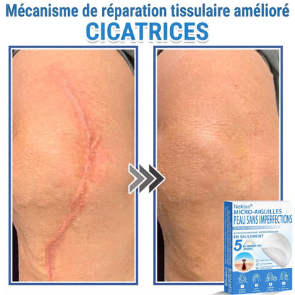 💧💧 𝑩𝒐𝒖𝒕𝒊𝒒𝒖𝒆 𝑶𝒇𝒇𝒊𝒄𝒊𝒆𝒍𝒍𝒆|𝐍𝐞𝐊𝐢𝐬𝐬® 🌿𝐏𝐚𝐭𝐜𝐡 𝐇𝐲𝐝𝐫𝐨𝐜𝐨𝐥𝐥𝐨ï𝐝𝐞 𝐁𝐨𝐭𝐚𝐧𝐢𝐪𝐮𝐞 à 𝐌𝐢𝐜𝐫𝐨-𝐀𝐢𝐠𝐮𝐢𝐥𝐥𝐞𝐬( 𝐂𝐢𝐛𝐥𝐞 𝐥𝐞𝐬 𝐚𝐜𝐫𝐨𝐜𝐡𝐨𝐫𝐝𝐨𝐧𝐬, 𝐩𝐞𝐭𝐢𝐭𝐞𝐬 𝐞𝐱𝐜𝐫𝐨𝐢𝐬𝐬𝐚𝐧𝐜𝐞𝐬, 𝐯𝐞𝐫𝐫𝐮𝐞𝐬, 𝐠𝐫𝐚𝐢𝐧𝐬 𝐝𝐞 𝐛𝐞𝐚𝐮𝐭é, 𝐭𝐚𝐜𝐡𝐞𝐬 𝐝𝐞 𝐯𝐢𝐞𝐢𝐥𝐥𝐞𝐬𝐬𝐞 𝐞𝐭 𝐚𝐮𝐭𝐫𝐞𝐬 𝐢𝐦𝐩𝐞𝐫𝐟𝐞𝐜𝐭𝐢𝐨𝐧𝐬 𝐜𝐮𝐭𝐚𝐧é𝐞𝐬 𝐨𝐮 𝐩𝐢𝐠𝐦𝐞𝐧𝐭𝐚𝐢𝐫𝐞𝐬 )