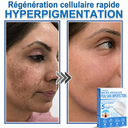 👩‍⚕️🎁 𝑩𝒐𝒖𝒕𝒊𝒒𝒖𝒆 𝑶𝒇𝒇𝒊𝒄𝒊𝒆𝒍𝒍𝒆|🌿Pansements hydrocolloïdes à micro-aiguilles 𝑵𝐞𝑲𝐢𝐬𝐬® 2-en-1
