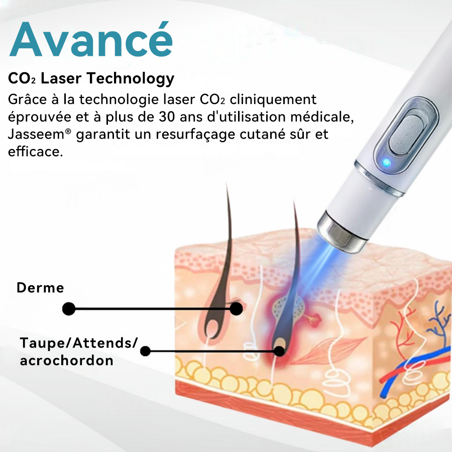 𝐉𝐚𝐬𝐬𝐞𝐞𝐦® Stylo Laser de Qualité Médicale 🏆 (utilise la technologie laser au CO₂ – efficace pour éliminer les grains de beauté, les verrues, les acrochordons, les taches pigmentaires et autres imperfections)🔥