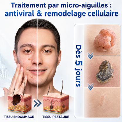 👩‍⚕️🎉 𝐵𝑜𝑢𝑡𝑖𝑞𝑢𝑒 𝑂𝑓𝑓𝑖𝑐𝑖𝑒𝑙𝑙𝑒 | 𝑵𝐞𝒌𝐢𝐬𝐬® 🌿𝑴𝒊𝒄𝒓𝒐𝒏𝒆𝒆𝒅𝒍𝒆𝒔 𝑷𝒆𝒂𝒖 𝑷𝒂𝒓𝒇𝒂𝒊𝒕𝒆 É𝒍𝒊𝒎𝒊𝒏𝒂𝒕𝒊𝒐𝒏 𝑫𝒆𝒔 𝑽𝒆𝒓𝒓𝒖𝒆𝒔 𝑷𝒂𝒕𝒄𝒉 (𝑃𝑜𝑢𝑟 𝑙𝑒𝑠 𝑎𝑐𝑟𝑜𝑐ℎ𝑜𝑟𝑑𝑜𝑛𝑠, 𝑙𝑒𝑠 𝑝𝑒𝑡𝑖𝑡𝑒𝑠 𝑒𝑥𝑐𝑟𝑜𝑖𝑠𝑠𝑎𝑛𝑐𝑒𝑠 𝑐𝑢𝑡𝑎𝑛é𝑒𝑠, 𝑙𝑒𝑠 𝑣𝑒𝑟𝑟𝑢𝑒𝑠, 𝑙𝑒𝑠 𝑔𝑟𝑎𝑖𝑛𝑠 𝑑𝑒 𝑏𝑒𝑎𝑢𝑡é, 𝑙𝑒𝑠 𝑡𝑎𝑐ℎ𝑒𝑠 𝑑𝑒 𝑣𝑖𝑒𝑖𝑙𝑙𝑒𝑠𝑠𝑒 𝑒𝑡 𝑙𝑒𝑠 𝑝𝑟𝑜𝑏𝑙è𝑚𝑒𝑠 𝑑𝑒 𝑝𝑖𝑔𝑚𝑒𝑛𝑡𝑎𝑡𝑖𝑜𝑛)