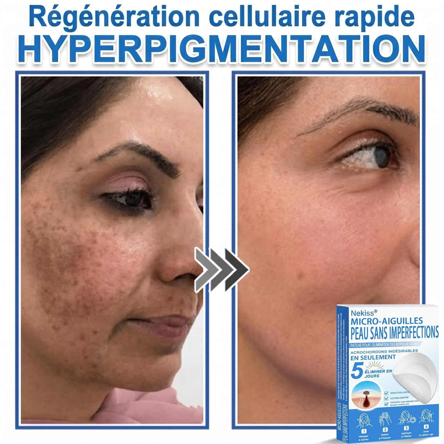 💧💧 𝑩𝒐𝒖𝒕𝒊𝒒𝒖𝒆 𝑶𝒇𝒇𝒊𝒄𝒊𝒆𝒍𝒍𝒆|𝐍𝐞𝐊𝐢𝐬𝐬® 🌿𝐏𝐚𝐭𝐜𝐡 𝐇𝐲𝐝𝐫𝐨𝐜𝐨𝐥𝐥𝐨ï𝐝𝐞 𝐁𝐨𝐭𝐚𝐧𝐢𝐪𝐮𝐞 à 𝐌𝐢𝐜𝐫𝐨-𝐀𝐢𝐠𝐮𝐢𝐥𝐥𝐞𝐬( 𝐂𝐢𝐛𝐥𝐞 𝐥𝐞𝐬 𝐚𝐜𝐫𝐨𝐜𝐡𝐨𝐫𝐝𝐨𝐧𝐬, 𝐩𝐞𝐭𝐢𝐭𝐞𝐬 𝐞𝐱𝐜𝐫𝐨𝐢𝐬𝐬𝐚𝐧𝐜𝐞𝐬, 𝐯𝐞𝐫𝐫𝐮𝐞𝐬, 𝐠𝐫𝐚𝐢𝐧𝐬 𝐝𝐞 𝐛𝐞𝐚𝐮𝐭é, 𝐭𝐚𝐜𝐡𝐞𝐬 𝐝𝐞 𝐯𝐢𝐞𝐢𝐥𝐥𝐞𝐬𝐬𝐞 𝐞𝐭 𝐚𝐮𝐭𝐫𝐞𝐬 𝐢𝐦𝐩𝐞𝐫𝐟𝐞𝐜𝐭𝐢𝐨𝐧𝐬 𝐜𝐮𝐭𝐚𝐧é𝐞𝐬 𝐨𝐮 𝐩𝐢𝐠𝐦𝐞𝐧𝐭𝐚𝐢𝐫𝐞𝐬 )